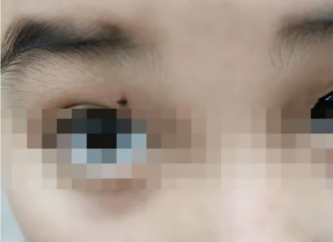 7岁男孩险遭同学刺瞎眼睛：如何教会孩子应对被欺负？