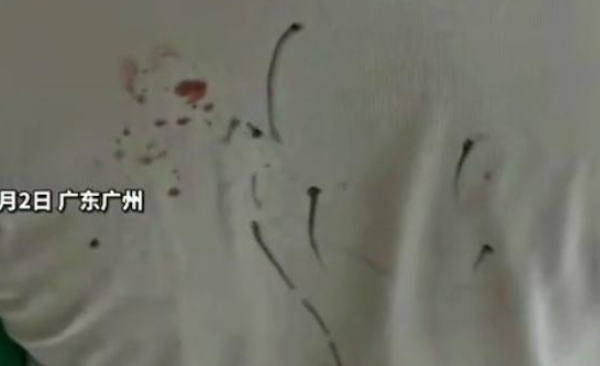 7岁男孩险遭同学刺瞎眼睛：如何教会孩子应对被欺负？